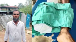 উখিয়া সীমান্তে মাইন বিস্ফোরণে যুবকের গোড়ালি বিচ্ছিন্ন